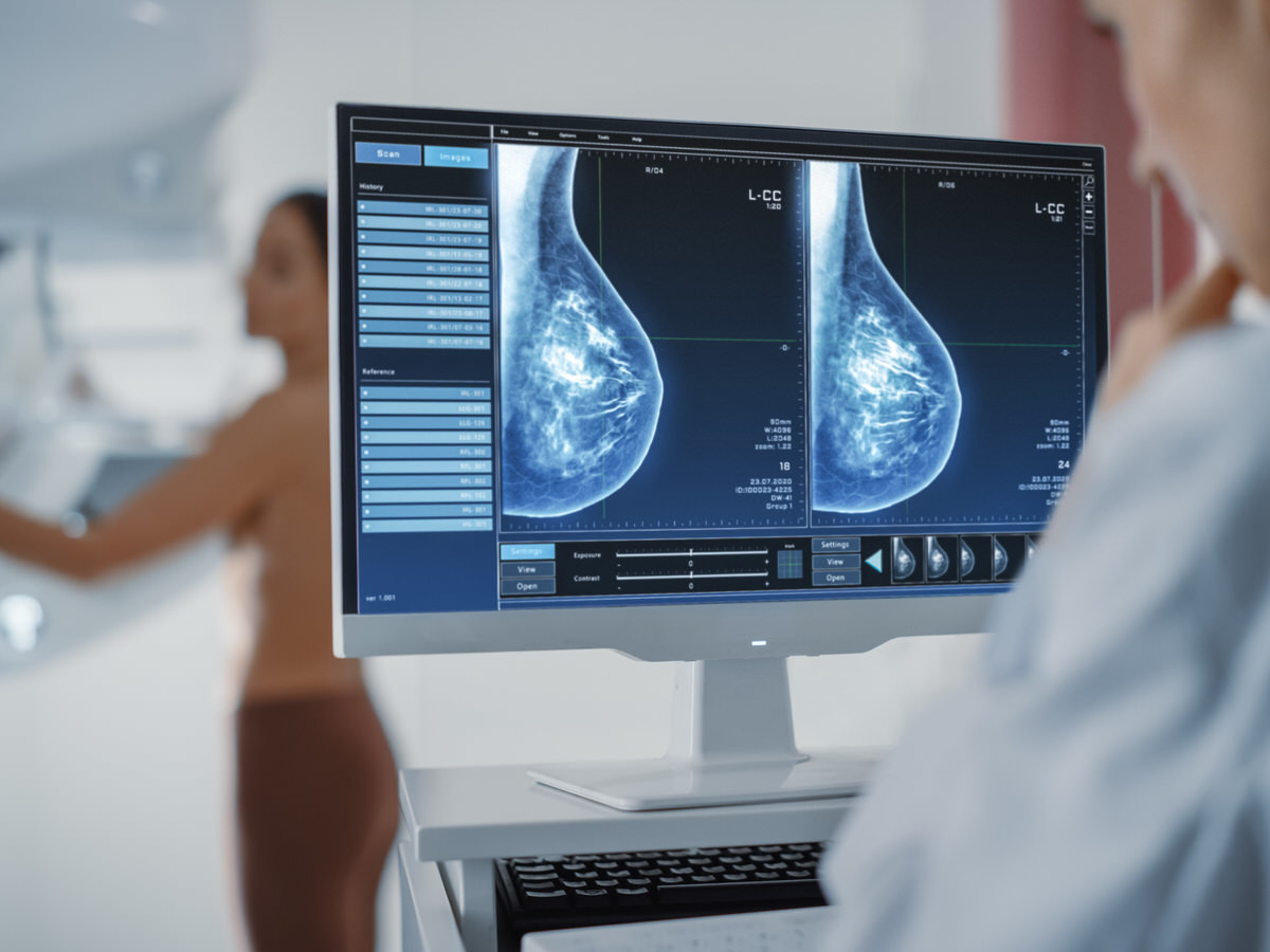 diagnostico imagen mamografia densitometria salutimes ecografia terrassa cst salud 1 uai by Kellenfol Ad.